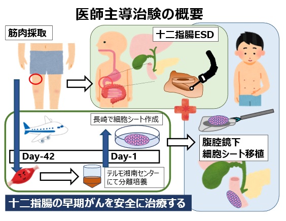 十二指腸腫瘍に対する再生医療を用いた新規手術術式の開発