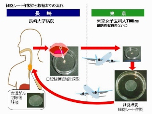 細胞シート作成から移植までの流れ