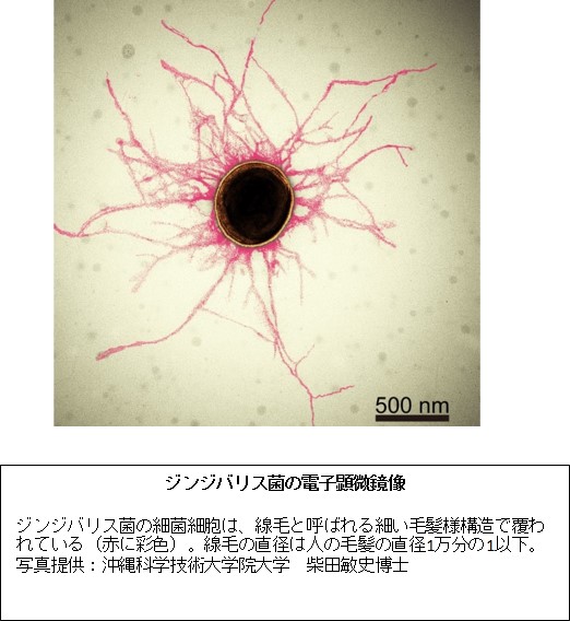 シンジバリス菌の電子顕微鏡像